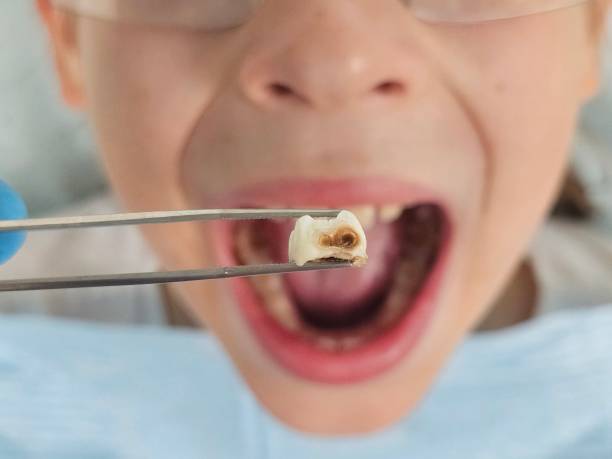 Best Urgent Tooth Repair  in Ben Avon, SC